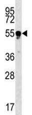 Tubulin beta 4Q Antibody (TUBB4Q)
