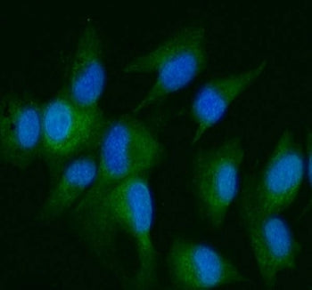 DDR2 Antibody