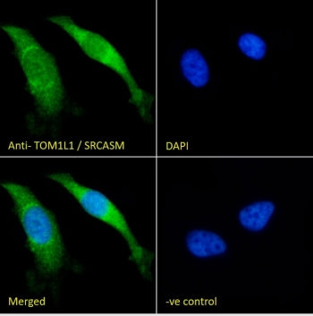 TOM1L1 Antibody