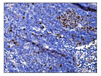 Ki-67 Antibody