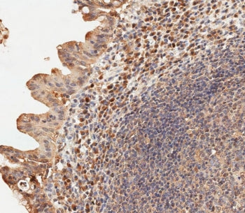 USP15 Antibody