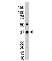 UCH37 Antibody
