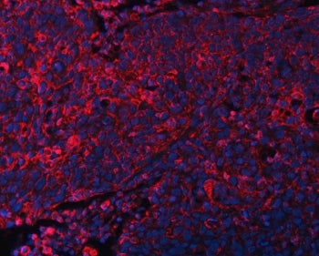 DOCK1 Antibody / Dedicator of cytokinesis protein 1