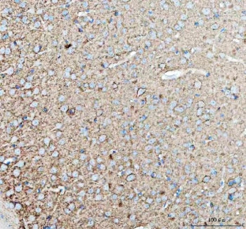 TNR Antibody