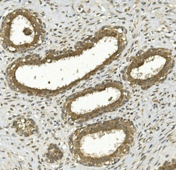 NRF-2 Antibody / NRF2L2