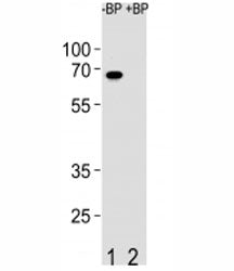 Western blot analysis of ETV5 antibody pre-incubated without (Lane 1) and with (2) blocking peptide
