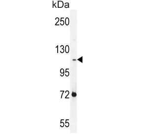 Protocadherin alpha-C2 Antibody / PCDHAC2