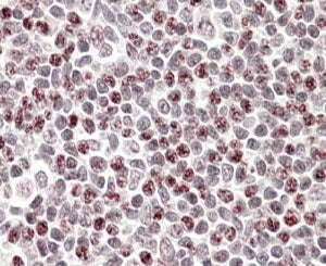 APOBEC3A Antibody