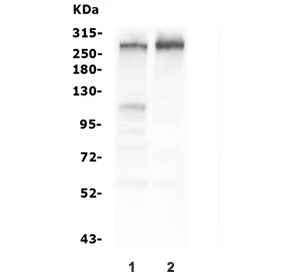 TSC2 Antibody / Tuberin