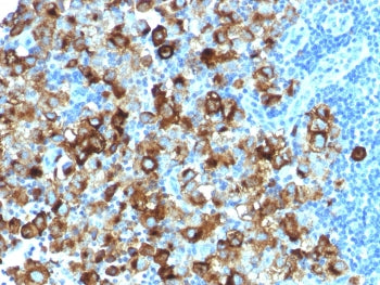 PMEL17 / Melanoma gp100 Antibody