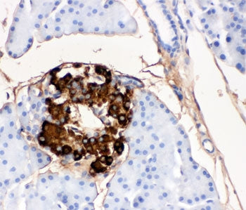 Insulin Antibody