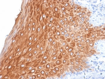 KRT16 Antibody / Cytokeratin 16