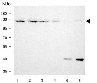 RNF20 Antibody / BRE1A