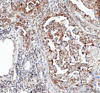 VE Cadherin Antibody / CDH5 (Intracellular Junction Marker)