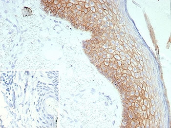 IHC staining of FFPE human skin tissue with DSG3 antibody (clone rDSG3/8611). Inset: PBS used in pla