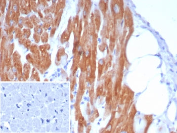 Alpha B Crystallin Antibody / CRYAB