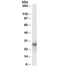Galectin-3 Antibody