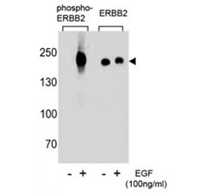 p-ErbB2 Antibody (pY1248)