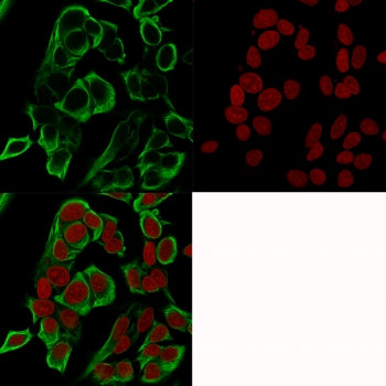 EpCAM Antibody