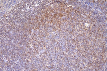 IHC staining of FFPE human tonsil with DCK antibody. HIER: boil tissue sections in pH8 EDTA buffer,