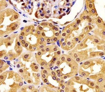 PGK1 Antibody
