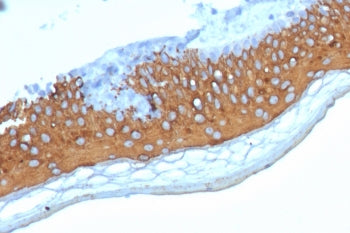 IHC staining of FFPE human skin tissue with Cytokeratin 10 antibody (clone KRT10/7804R) at 2ug/ml. H