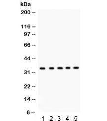 Western blot testing of 1) rat testis, 2) human 22RV1, 3) HeLa, 4) MCF7, and 5) Jurkat lysate with E