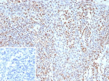 IHC staining of FFPE human tonsil tissue with recombinant Bcl-6 antibody (clone BCL6/9222R). Inset: