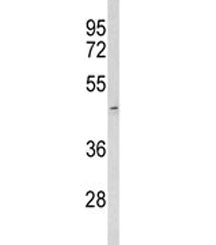 Western blot analysis of ACR antibody and human T47D lysate. Predicted molecular weight ~46 kDa.