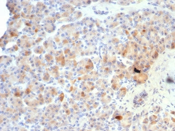 Somatostatin Antibody / Neuronostatin 