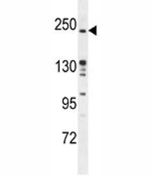 RICTOR Antibody