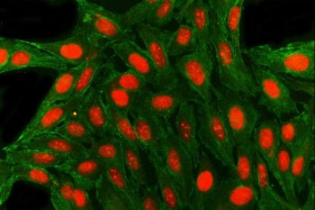 SAE1 Antibody / SUMO-1 activating enzyme subunit 1