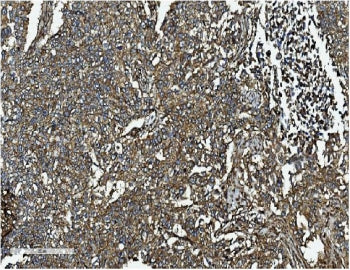 Clathrin Heavy Chain Antibody