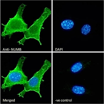 IF/ICC staining of fixed and permeabilized mouse NIH 3T3 cells with NUMB antibody (green) at 10ug/ml