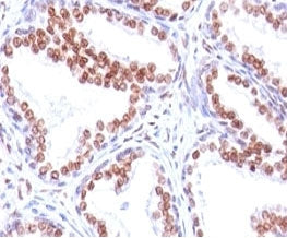 Androgen Receptor Antibody