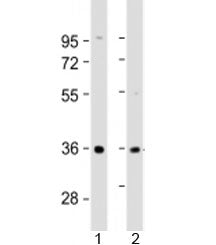 AKR7A3 Antibody / Aldo keto reductase family 7 member A3