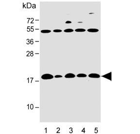 Western blot testing of human 1) T-47D, 2) PC3, 3) SW480, 4) HT-29 and 5) PANC-1 cell lysate with IF