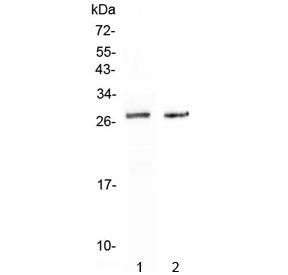 SPR Antibody / Sepiapterin reductase