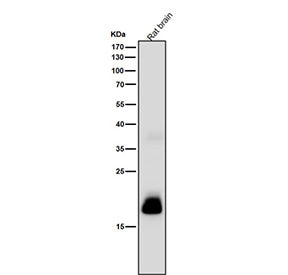 Rat brain tissue lysate tested with CRP antibody at 1:1000 dilution for 1 hour at room temperature.