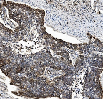 Proteasome subunit beta type-5 Antibody / PSMB5 / MB1
