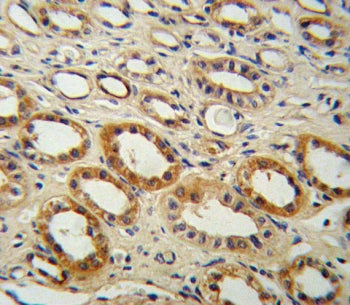 CYP27B1 Antibody