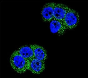 Platelet Derived Growth Factor Receptor beta Antibody (PDGFRB)