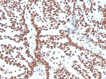 Estrogen Receptor alpha Antibody