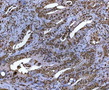 LRH1 Antibody / NR5A2
