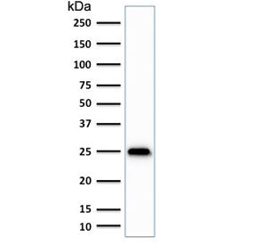 PGP9.5 / UchL1 Antibody