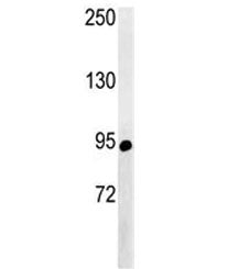 ABCF1 Antibody
