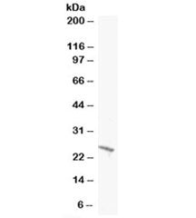 BAK1 Antibody