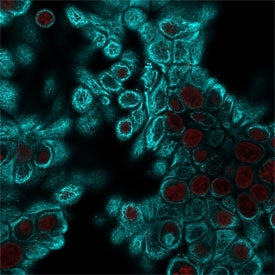 Pan Cytokeratin Antibody Cocktail (Acidic + Basic)
