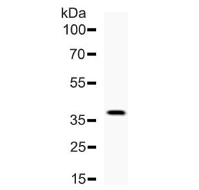 DKK1 Antibody