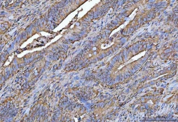 PROSER3 Antibody / Proline and serine-rich protein 3